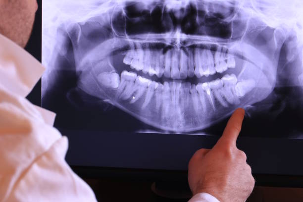 Best Emergency Treatment for Jaw Pain or Injury in Woodruff, SC